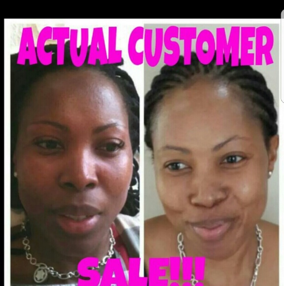 Other - 3 Terrific kojic lightening soap Other - 3 Terrific kojic lightening soap